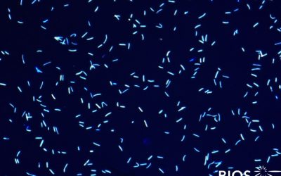 Plankton Profile: Oceanic Bacterioplankton IV