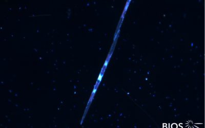 Plankton Profile: Pennate Diatom